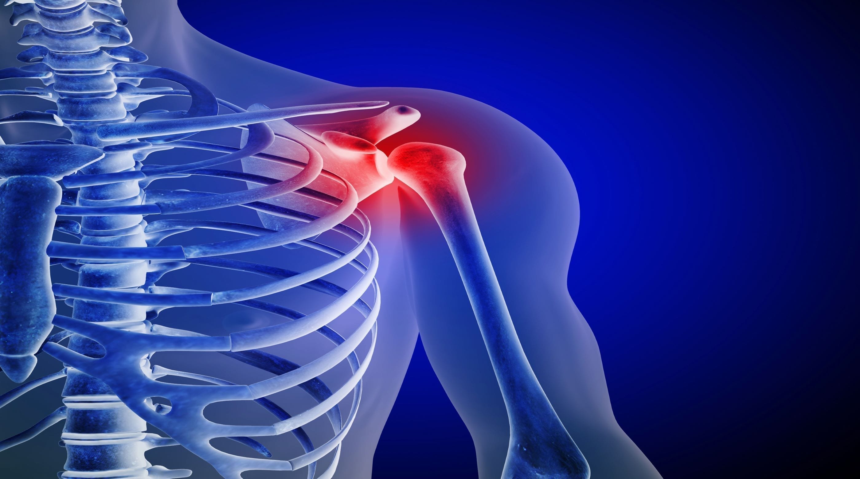 Learn Why Shoulder Impingement is Not the Rotator Cuff’s Fault