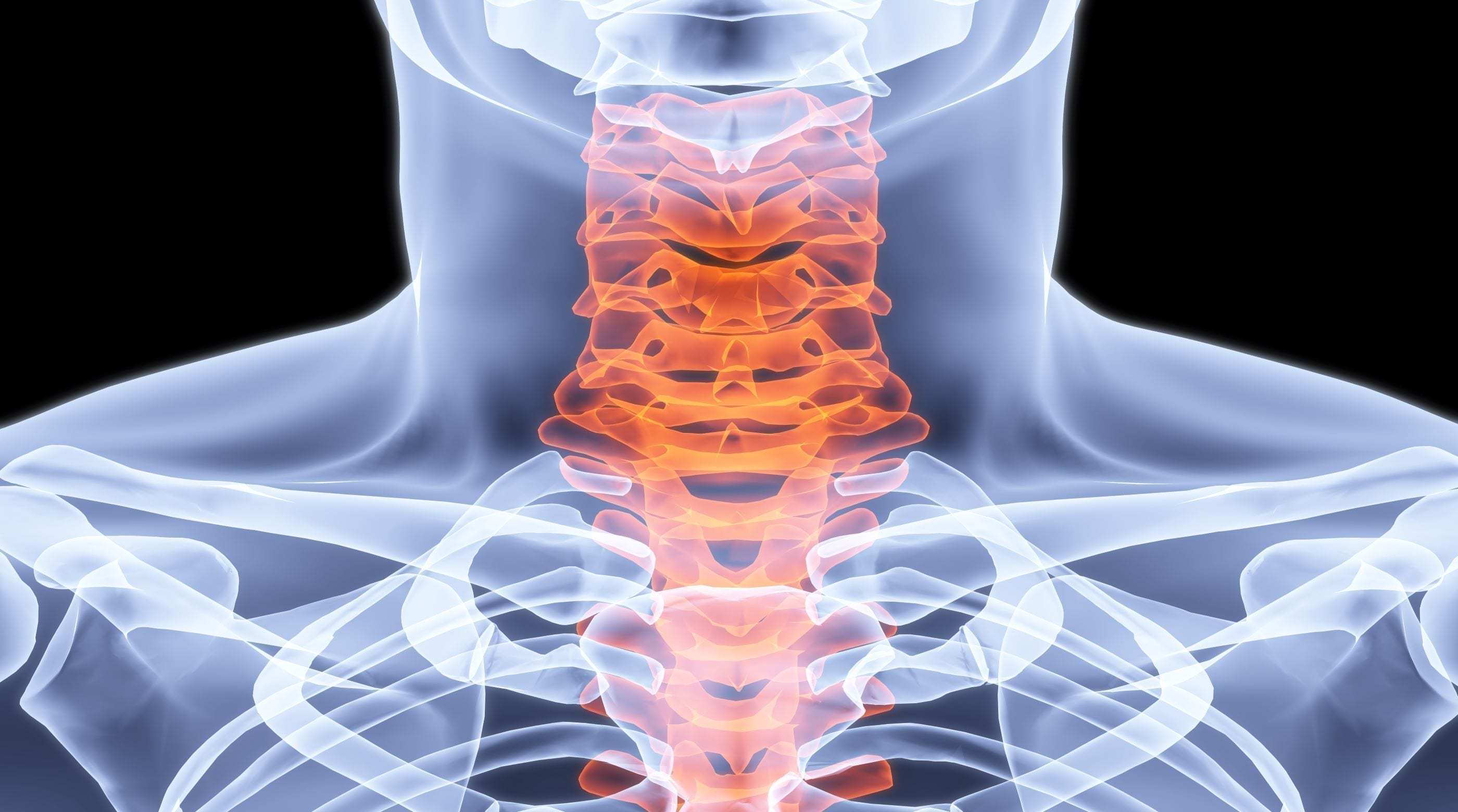 10 Clinical Randomized Trials: Structural Rehabilitation of the Cervical Spine