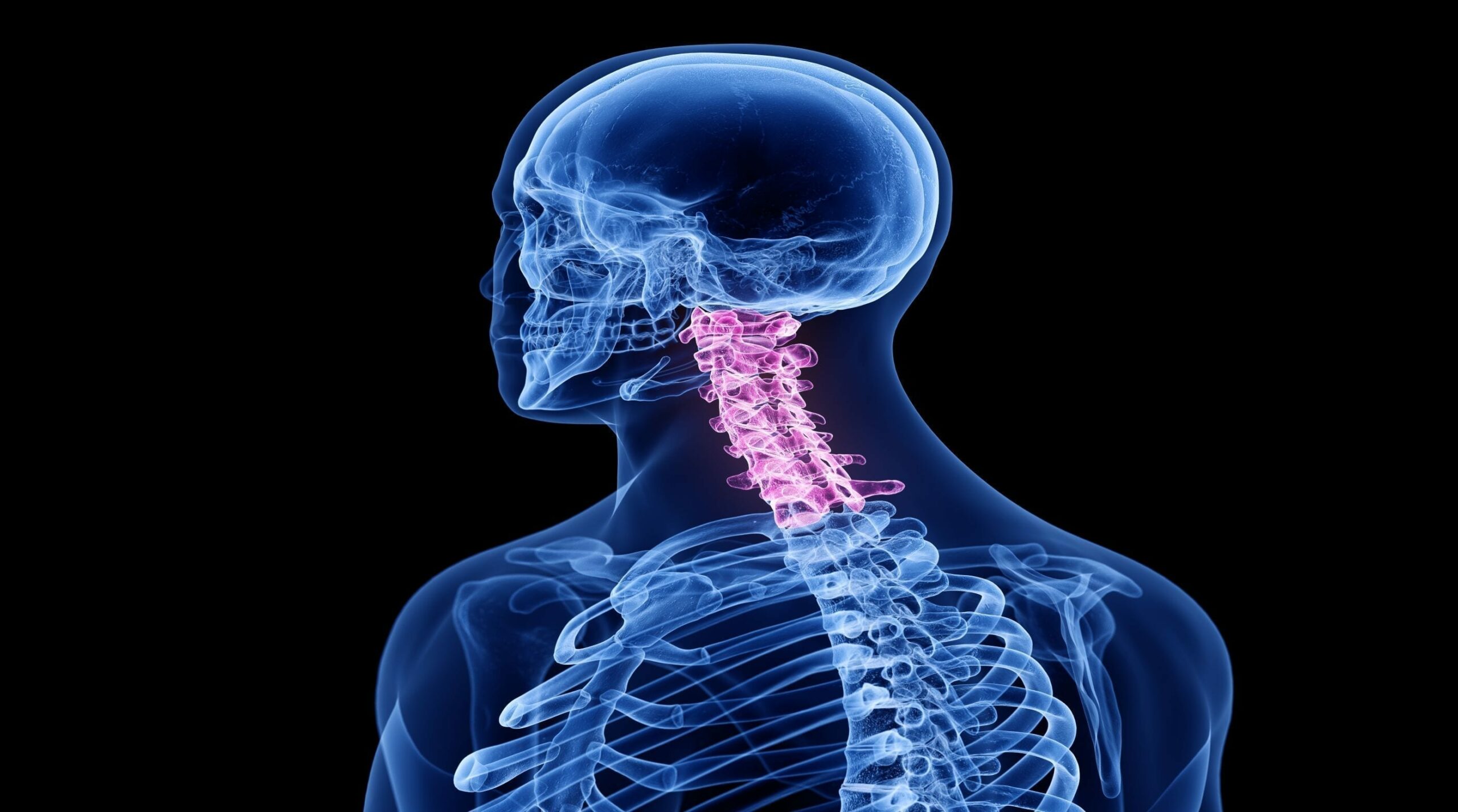 Structural Rehabilitation of the Cervical Spine (Module 4)