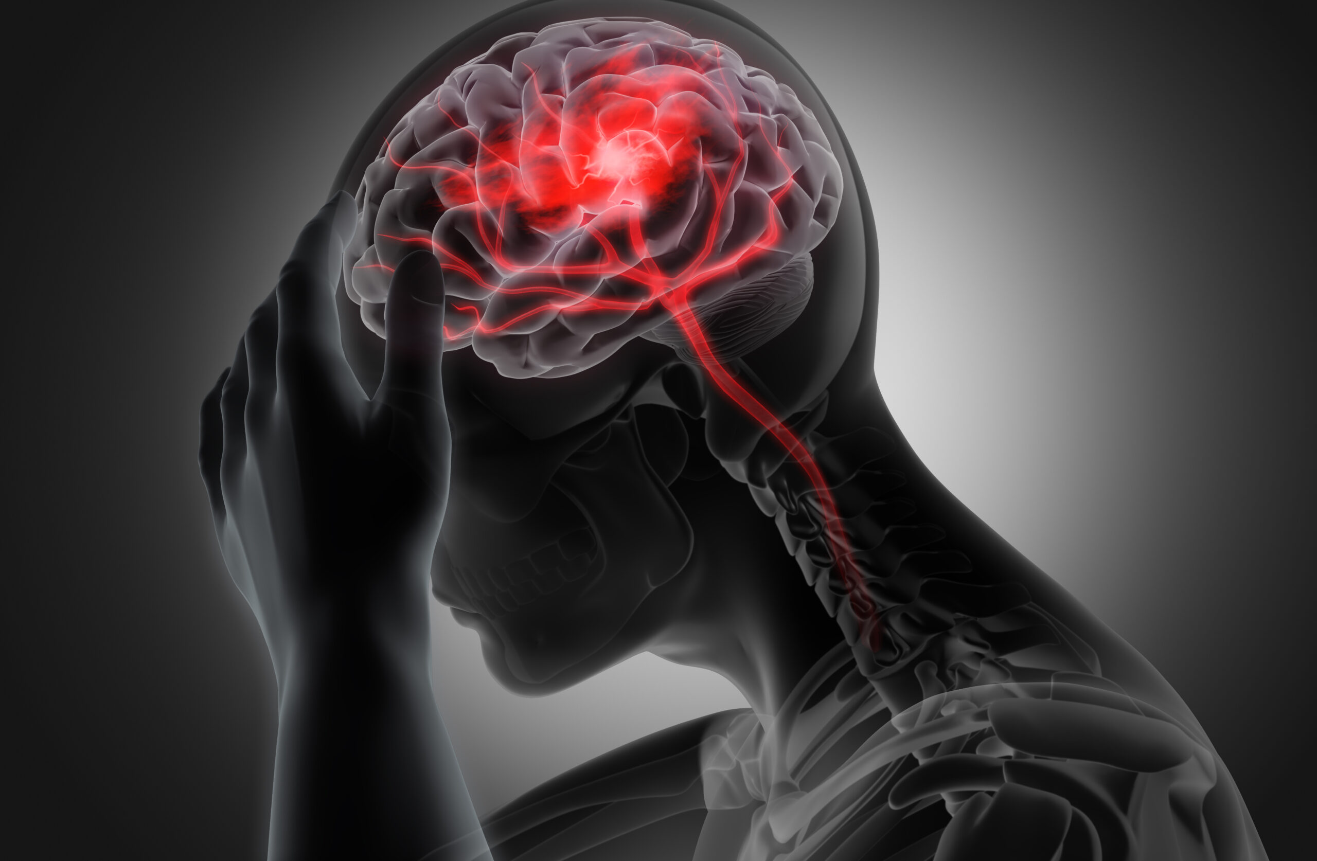 Traumatic Brain Injury (TBI) a Silent Epidemic